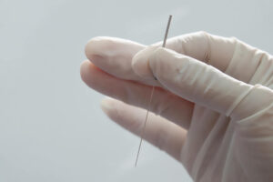dry needle